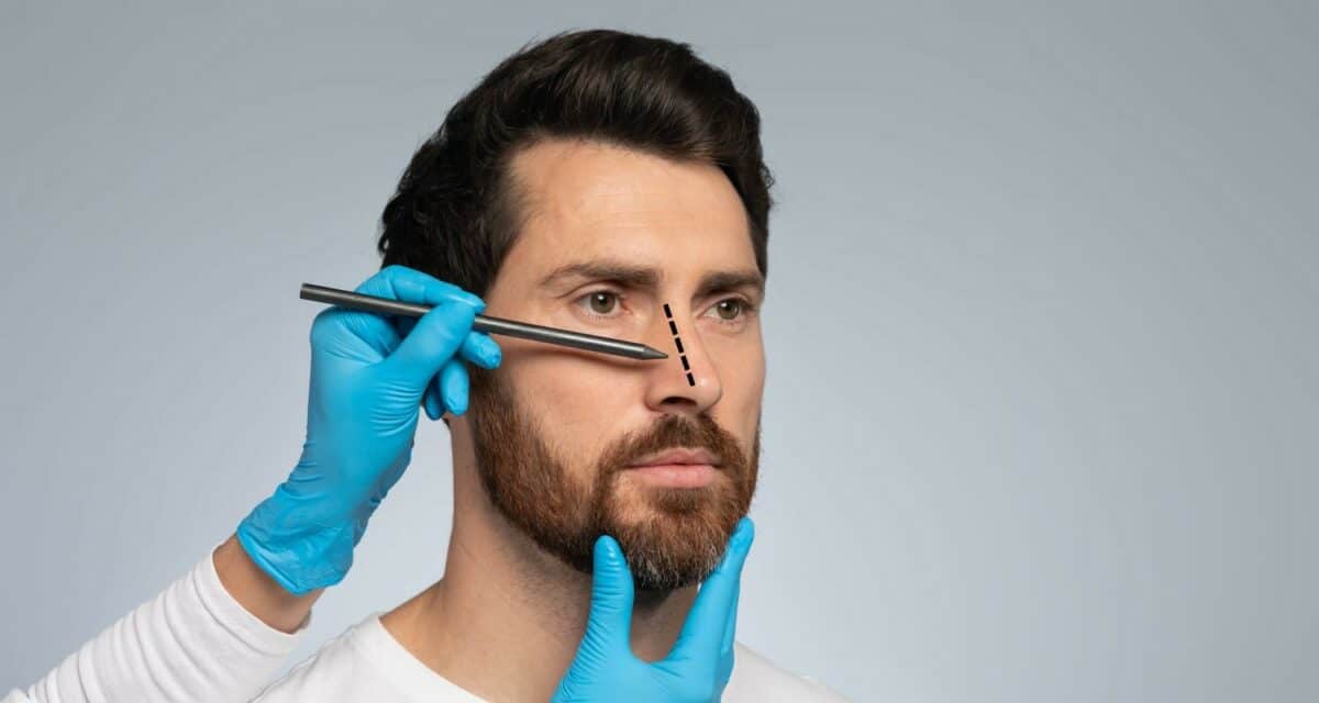 Rhinoplasty